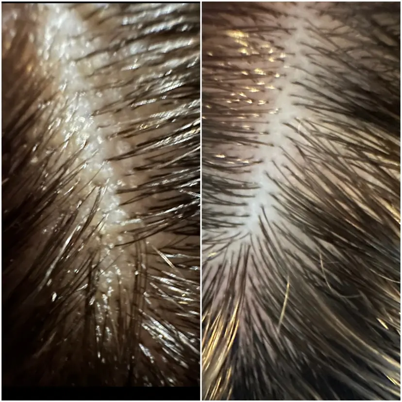 Scalp before Japanese Head Spa treatment