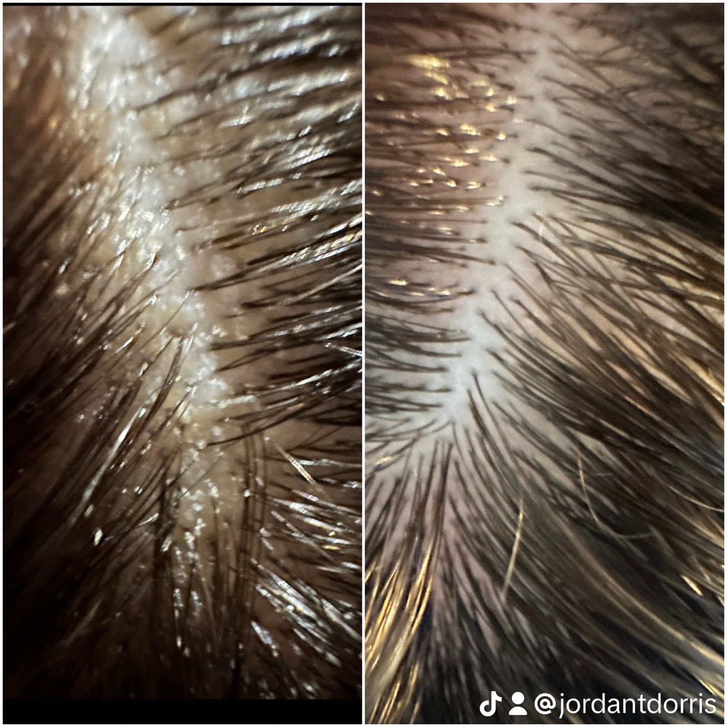 Client before and after, Smoother part, healthier hair shaft