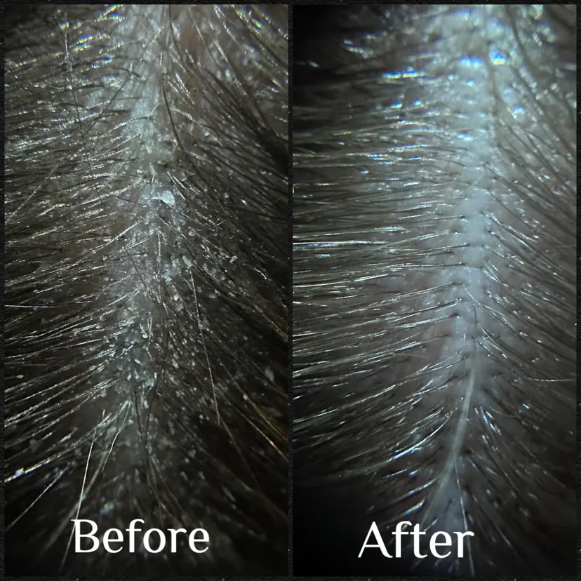 Client before and after, Dissolved congestion, brighter follicles